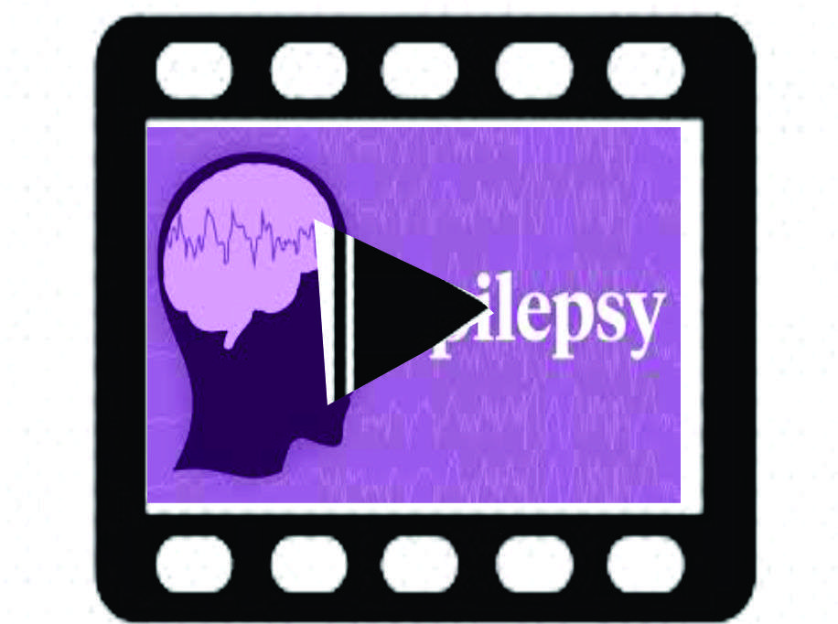 Dr. Ungar Talks about Religion & Medicine During Passover 84 DR UNGAR ON EPILEPSY